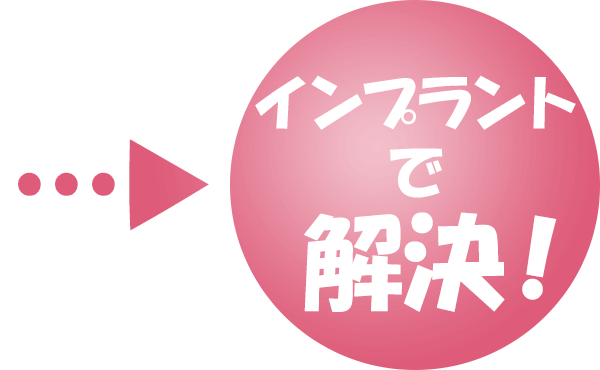 インプラントで解決!