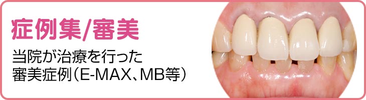 症例集/審美　当院が治療を行った審美症例（E-MAX、MB等